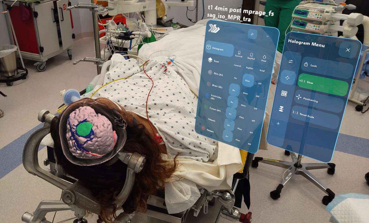 HOH pioneers use of HoloLens for brain surgery with neuronavigation